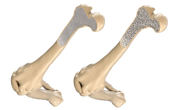 Human Thigh Bone - Il Mondo delle Donne